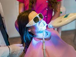 blue light teeth whitening is it safe