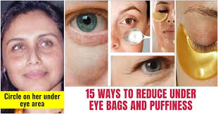 how to reduce bags under eyes indian