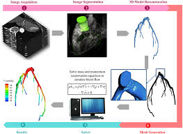 Frontiers Application Of Patient Specific Computational