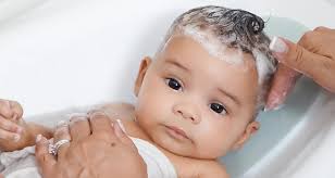 what is cradle cap the treatment