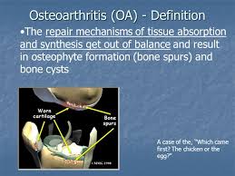 Assessing risk factors for early hip osteoarthritis in activity     SlidePlayer 