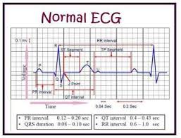 Ecg Study Normal Ecg Nursing Notes Heart Attack Symptoms