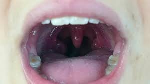 inside mouth images browse 202 708