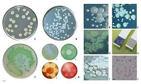pseudomonas bacteria characteristics