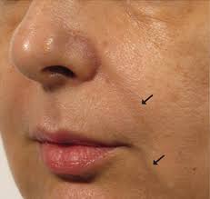 We all face aging and skin irritation from environmental stressors. Oxygen Therapy For Uneven Skin Tone Signature18 Clinic