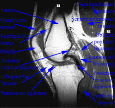 This webpage provides a gallery of images that presents the anatomical structures found on knee mri. Department Of Anatomy Med Univ Of Warsaw Poland Knee Mri Scan 38