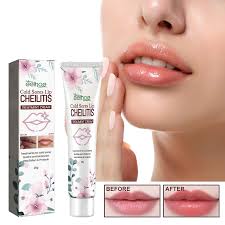 makeup lip herpes and cheilitis cream