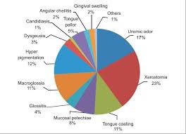 Pie Chart Showing Percentage Of Distribution Of The Various