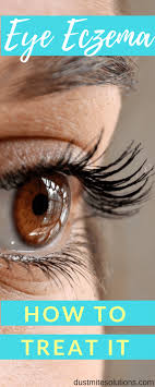 treating eczema around the eyes