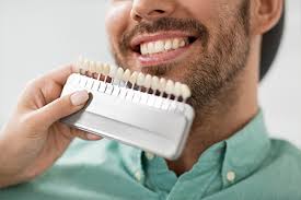 Cosmetic Dentistry Mesquite Teeth Whitening Porcelain