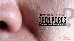 how to minimize open pores causes and