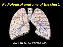 It is important to remember the position and orientation of the heart when placing a stethoscope on the chest of a patient and listening for heart sounds, and also when looking at images taken from a midsagittal perspective. Presentation1 Pptx Radiological Anatomy Of The Chest