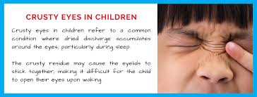 crusty eyes in children what every