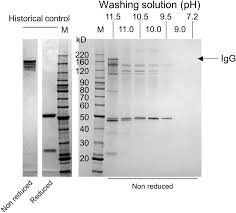 sds page ysis of washing fraction