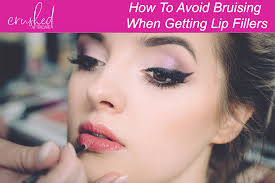 avoid bruising when getting lip fillers