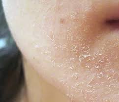korean skin care moisturizer to combat
