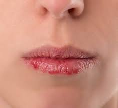 lip cancer dr mrkar