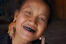black teeth or snaggle teeth anese