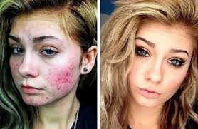 shocking makeup transformations before