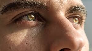 dry eyes after lasik causes symptoms