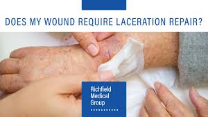 does my wound require laceration repair