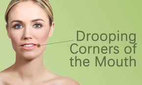 the mouth botox fillers treatment