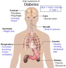 Free Research Projects  Diabetes Mellitus Research Paper SP ZOZ   ukowo