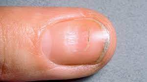 what s causing that black line on your nail