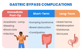 gastric byp complications symptoms