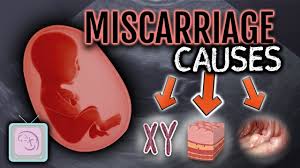 recur miscarriage testing