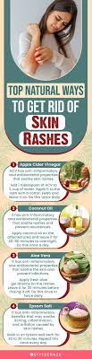 21 home remes to get rid of rashes