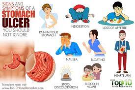 signs and symptoms of a stomach ulcer