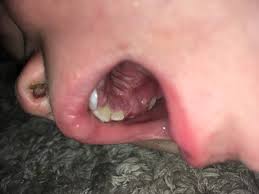 inside toddlers mouth mumsnet