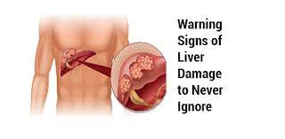 7 warning signs of liver damage to
