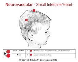 17 Tcm Headaches 6 Small Intestine Heart