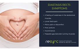 diastasis recti symptoms treatment