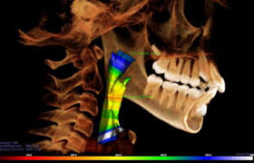 cbct imaging a boon to orthodontics