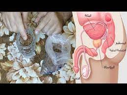 علاج التهاب البروستاتا نهائيا بملعقة واحدة من هذه الوصفة ستلاحظ انه تم القضاء على الالم مباشرة youtube 30 minute yoga prostate frame