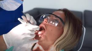 Katie price has shared a video of herself spitting out her old teeth as she had her veneers replaced while away in turkey recently. Katie Price Shocks Fans With Horrific Tooth Shaving Footage
