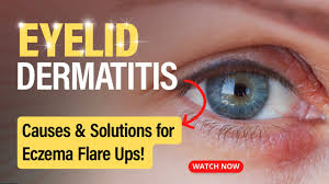 recognizing and treating eyelid dermais