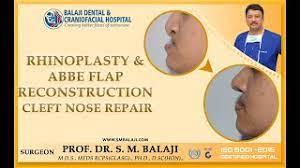 abbe flap reconstruction cleft nose repair