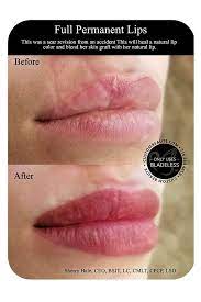 permanent lips in amherst buffalo and