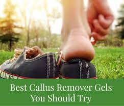 4 best callus remover gels you should