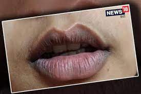 get rid of chapped and dark lips news18