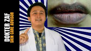 Selain faktor genetik, gaya hidup juga sangat memengaruhi kesehatan bibir. Bibir Hitam Inilah Penyebab Bibirmu Hitam Dan Cara Menghilangkannya Youtube