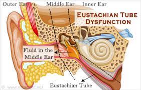 It could also be an indicator of a middle ear infection. Crackling In Ear Learn How To Stop Crackling Sound In Ear
