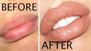 your lips look bigger in 5 minutes