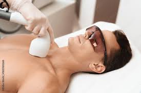 laser hair removal the doctor treats