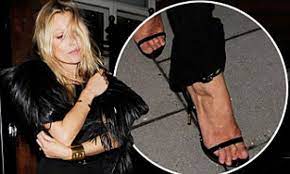 Kate Moss reveals claw-like toes | Daily Mail Online