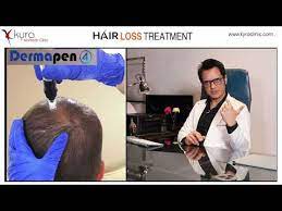 how often does letrozole cause hair loss